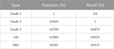 KD_ConvNeXt: knowledge distillation-based image classification of lung tumor surgical specimen sections